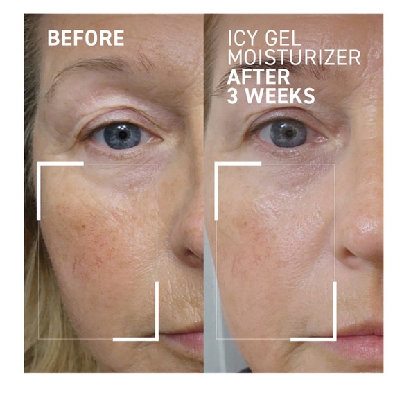 DR. BRANDT iD-Stress Icy Gel Moisturizer ~ 1.7fl ~ NEW IN BOX! - Picture 3 of 6